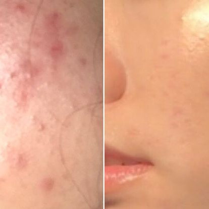 Saude hair skin and nails supplement