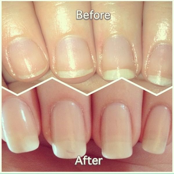 Saude hair skin and nails supplement