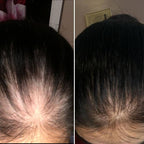 Saude hair skin and nails supplement