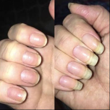 Saude hair skin and nails supplement