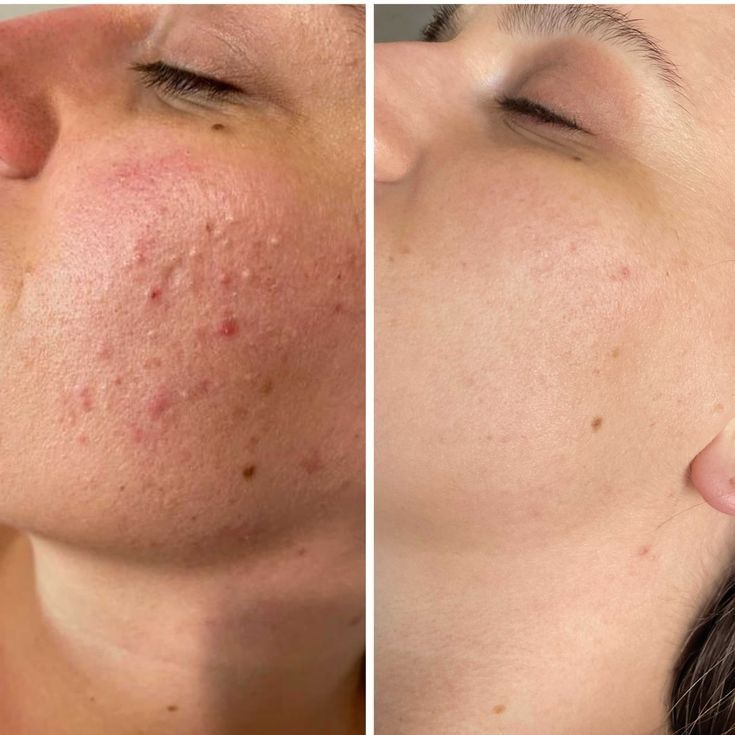 Saude hair skin and nails supplement