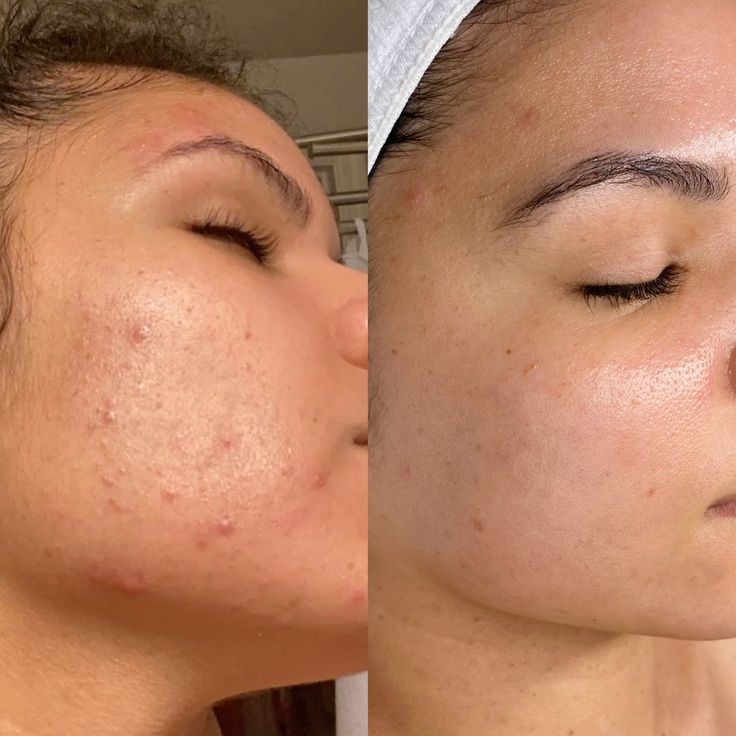 Saude hair skin and nails supplement